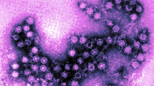 Informació d'interès sobre l'enterovirus -Imatge 1-